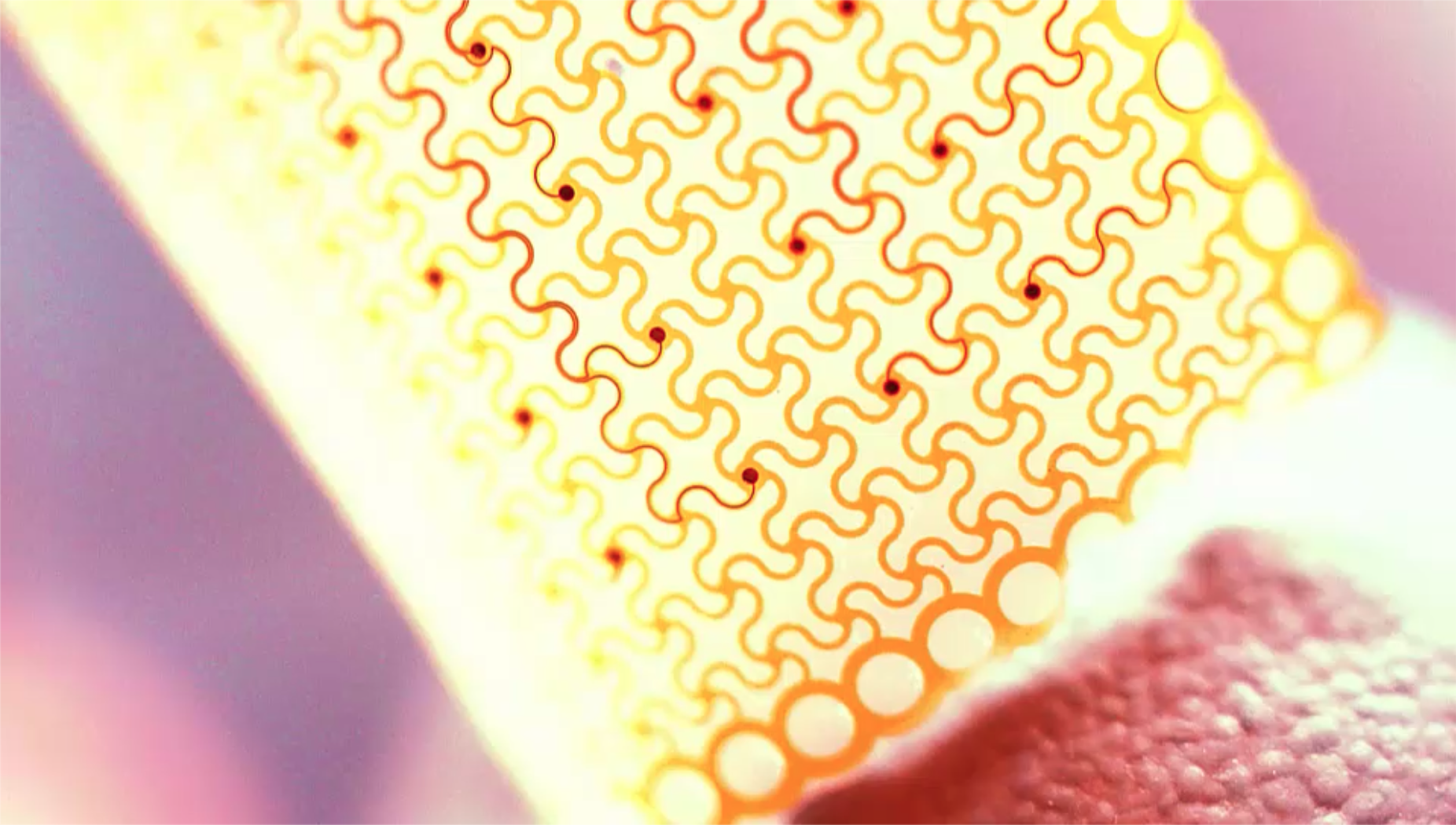 Revolutionary Stretchable AI Patch Transforms Wearable Health Tech!